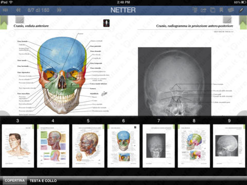 Netter su iPad